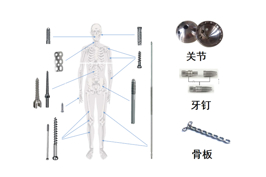 醫(yī)療骨科、牙釘、脊椎
